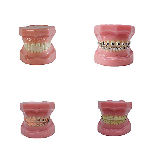 מודל סימולציה ריאליסטי של מודל שיניים מפלסטיק המשמש לחינוך שיניים ולתרגול