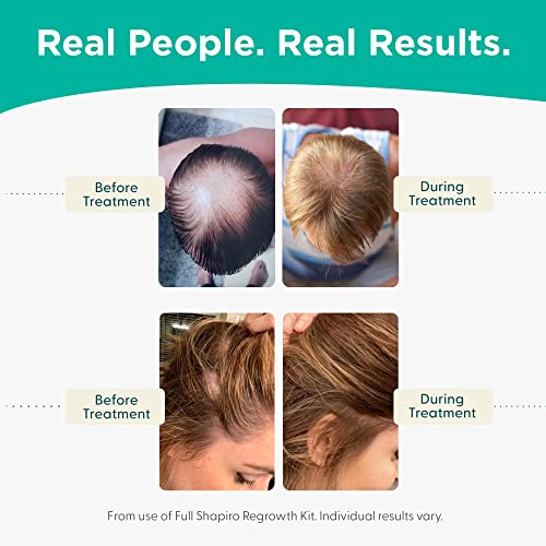 שמפו לנשירת שיער / פורמולה טבעונית נגד דה-טי לשיער דליל שפותחה על ידי רופאי עור / התנסות בשיער בריא, מלא