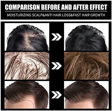 ביוטין שיער צמיחת סרום אנטי שיער אובדן מוצרים מהיר גידול שיער טיפול חיוני שמן בריאות קרקפת טיפולים לגברים נשים