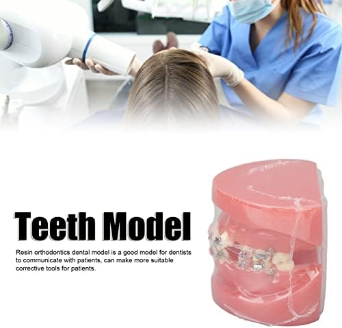 מודל שיניים, הדגמה של מודל שיניים אורתודונטיה מפורקת מודל שיני שרף להוראה, מחקר ומעבדת שיניים
